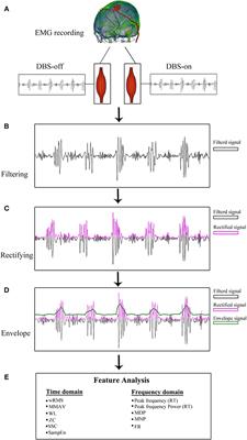 Electromyography Biomarkers for Quantifying the Intraoperative Efficacy of Deep Brain Stimulation in Parkinson's Patients With Resting Tremor